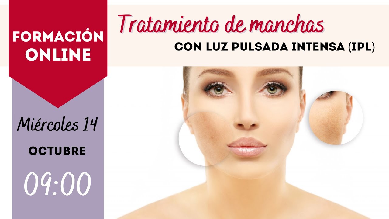 Tratamiento de manchas con IPL