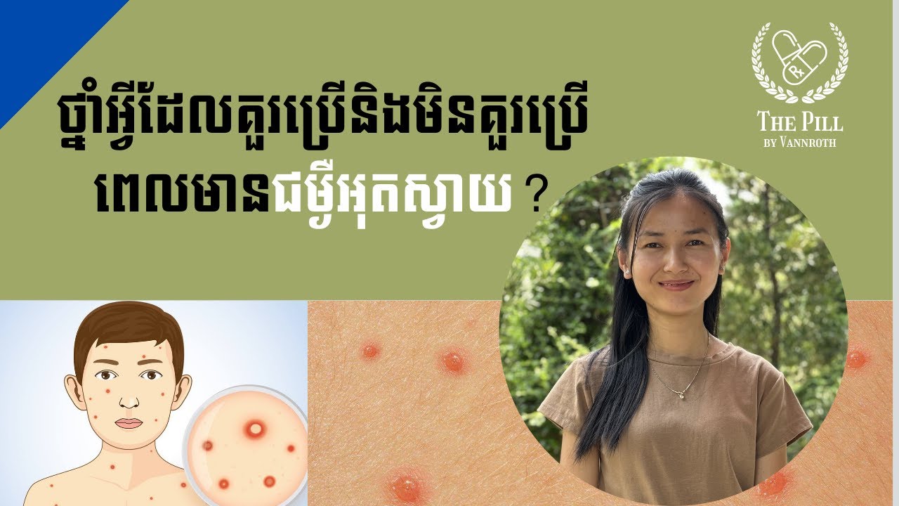 ជម្ងឺអុតស្វាយ - ថ្នាំអ្វីដែលគួរប្រើនិងមិនគួរប្រើពេលមានជម្ងឺអុតស្វាយ?