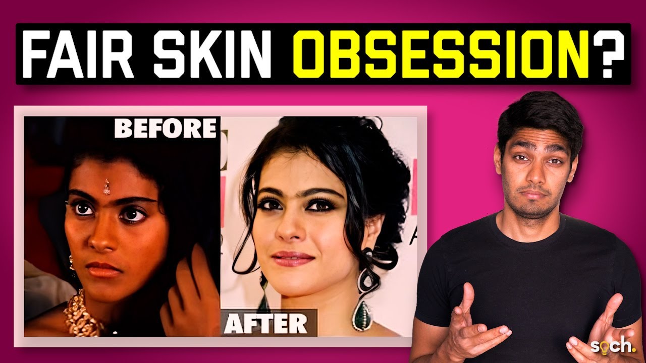 Gora gora rang: Why do Indians love fair skin so much?
