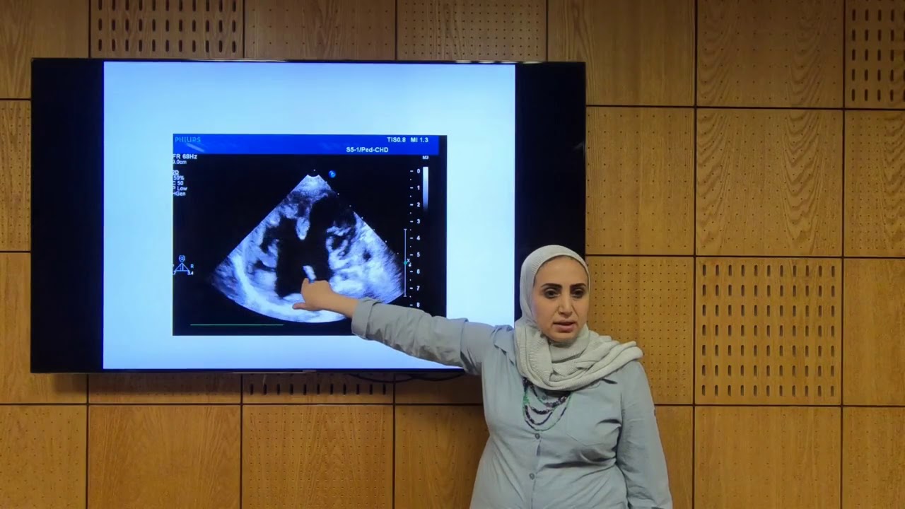 AVSD (AV Canal) - Soha Romeih