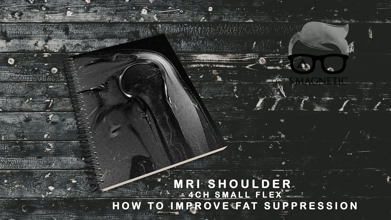 MRI SHOULDER WITH 4CH SMALL FLEX, HOW TO IMPROVE FAT SUPPRESSION