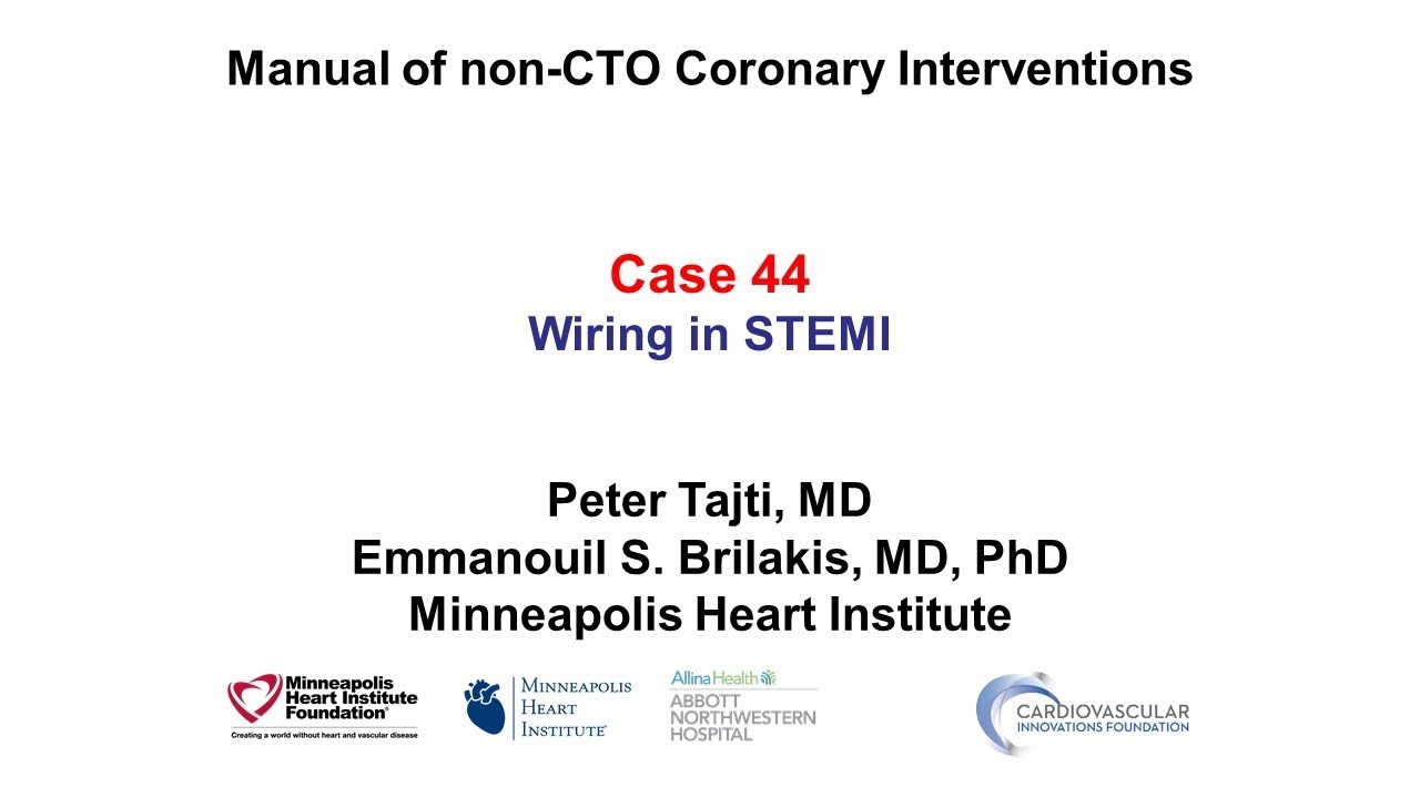 Case 44: PCI Manual - Wiring in STEMI