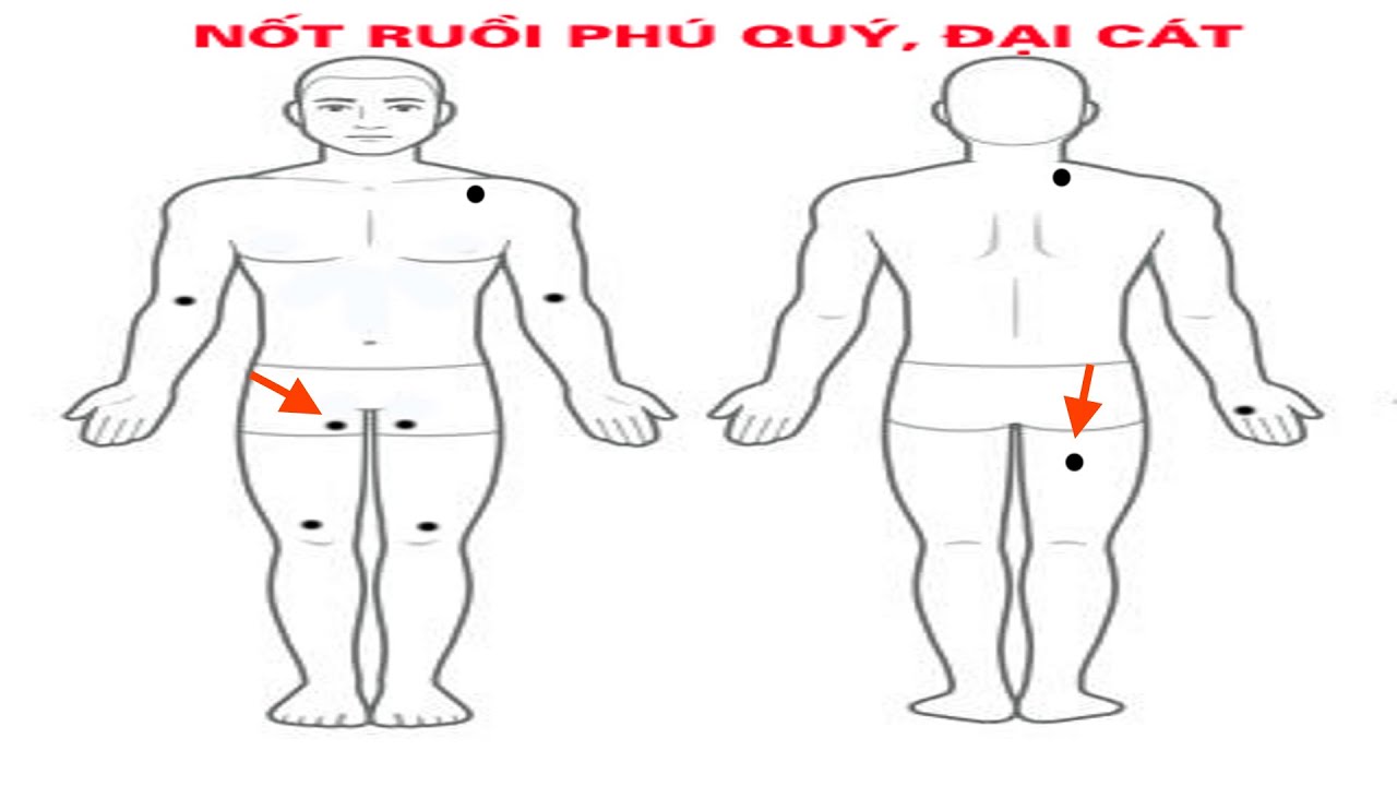 10 Nốt Ruồi Đại Cát, Đại Lợi Mang Lại Sự May Mắn, Giàu Sang, Sinh Con Quý Tử