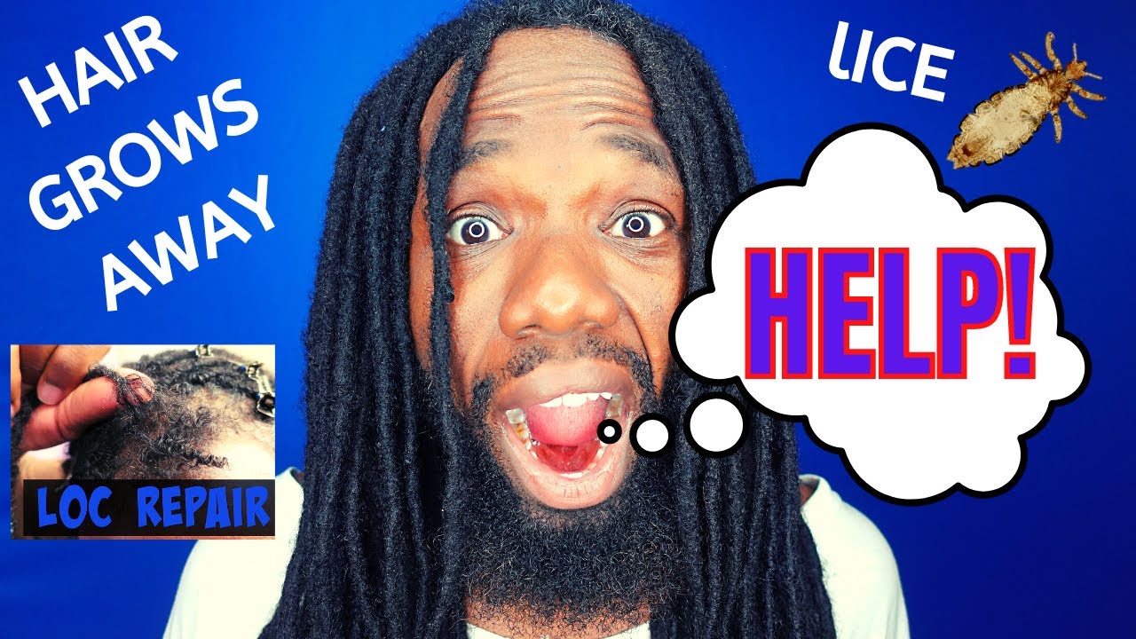 Hair Grows Away From Locs, Adding 4C Hair to 4A Texture, Lice in Dreadlocks, and More!