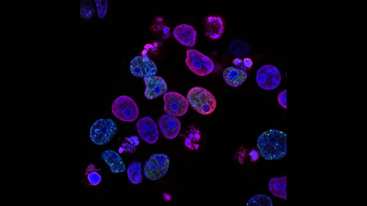 Cellular Memory is Beyond Anything You've Ever Learned About!