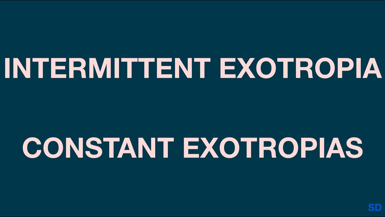 Strabismus and Pediatric: Session 11: Exodeviations
