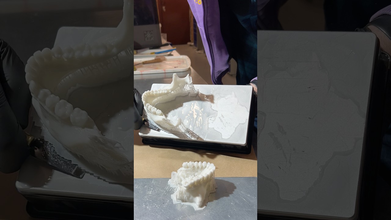 Печатаем челюсти полученные по КТ из фотополимера #harzlabs #3дпечать #3dprinting