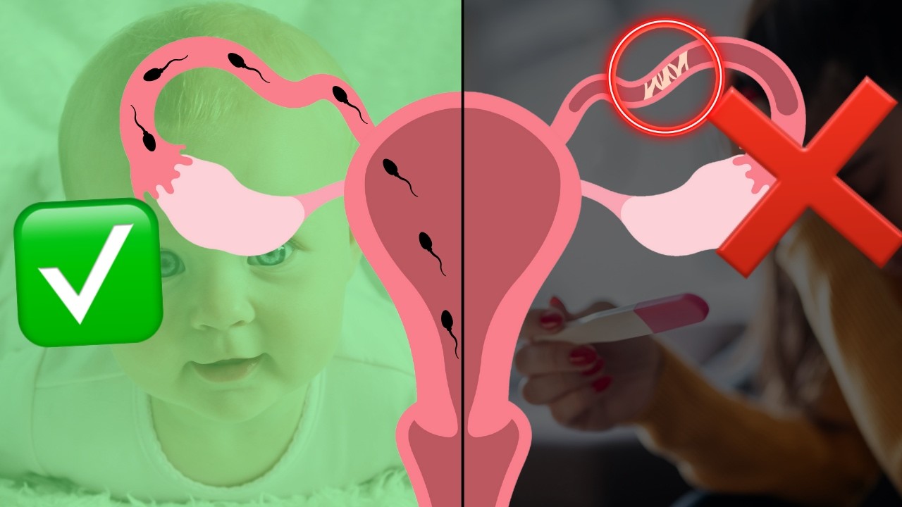 TROMPES BOUCHÉES : symptômes, causes et solutions pour tomber enceinte.