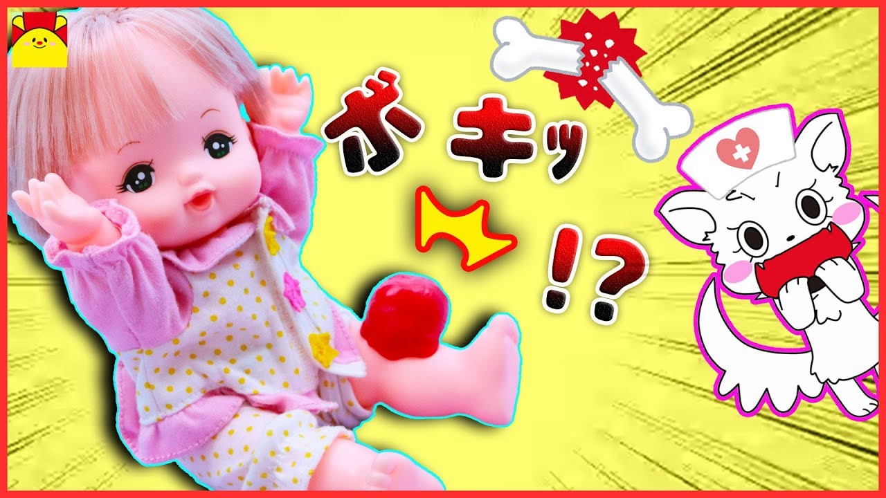 メルちゃんが骨折！？病院★ギブスで骨折のなおしかた★キネティックサンド お絵かき紹介 おままごと おゆうぎ ごっこ遊び サンサンキッズTV toys kids video