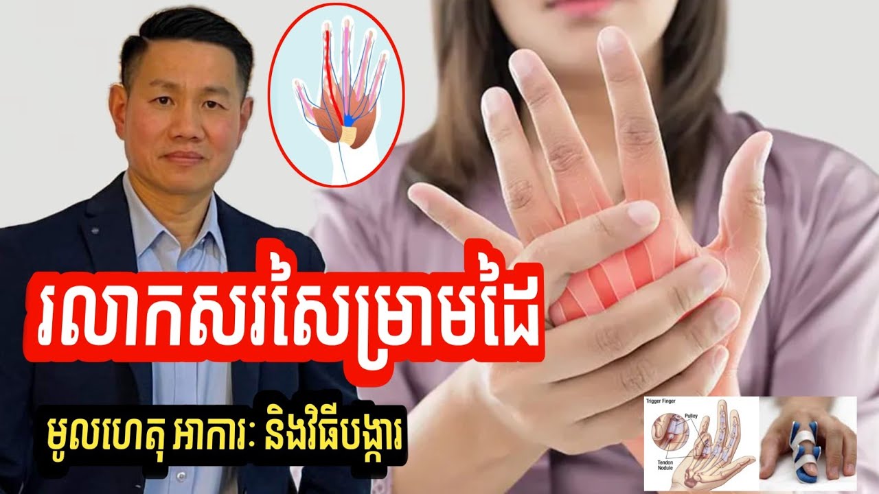រលាកសរសៃម្រាមដៃ | មូលហេតុ អាការៈ និងវិធីការពារ | លោក លី ប៉េង តែ Ly Peng Te