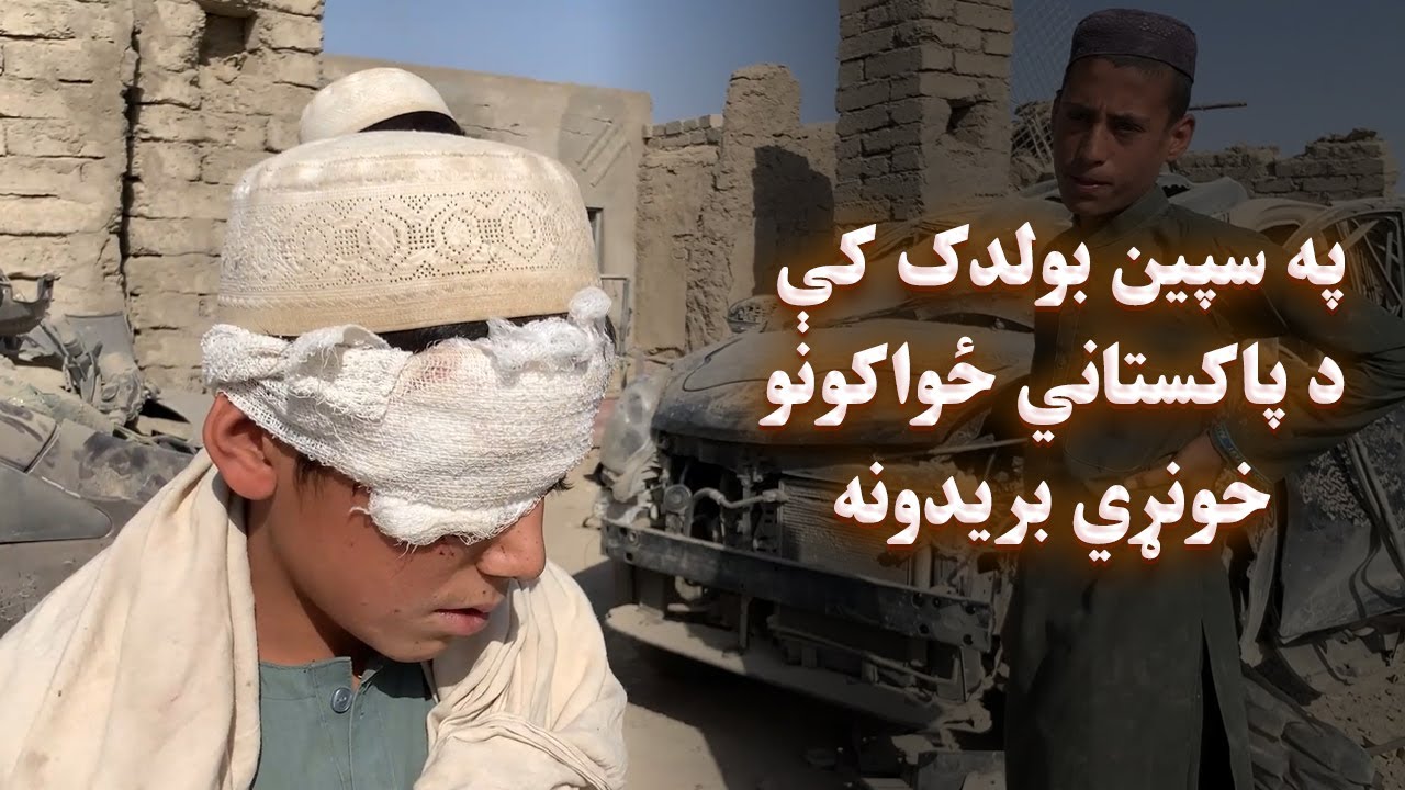 په سپین بولدک کې د پاکستاني ځواکونو خونړي بریدونه/Deadly Pakistani Attacks in Spin Boldak