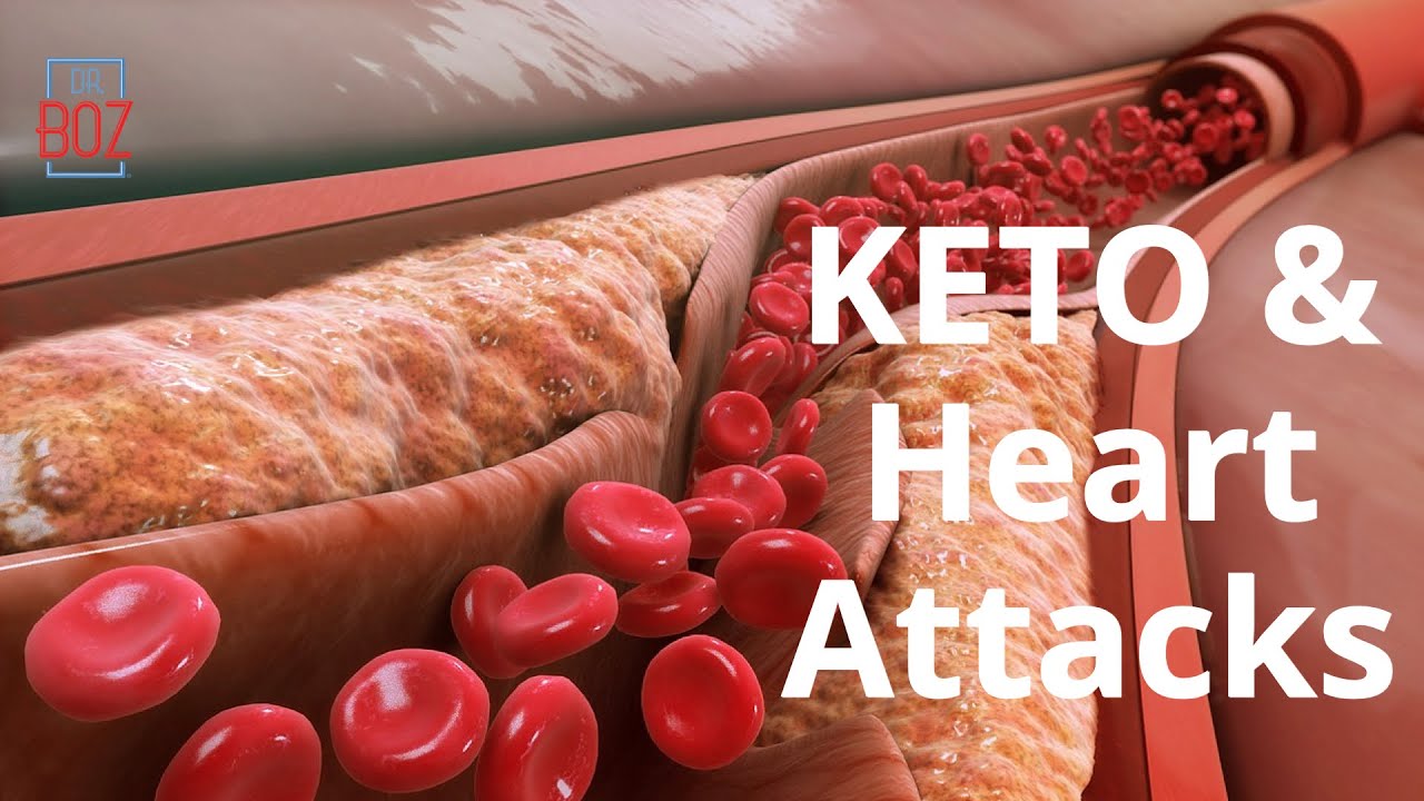 🔴 Live: KETO & Heart Attacks
