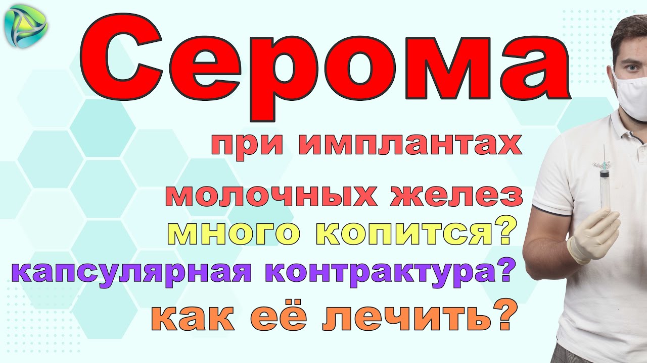 Серома при имплантах молочных желез | Капсулярная контрактура.