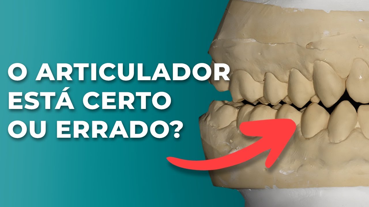 A MONTAGEM DO ARTICULADOR ESTÁ CERTA? - Mylene e Renato