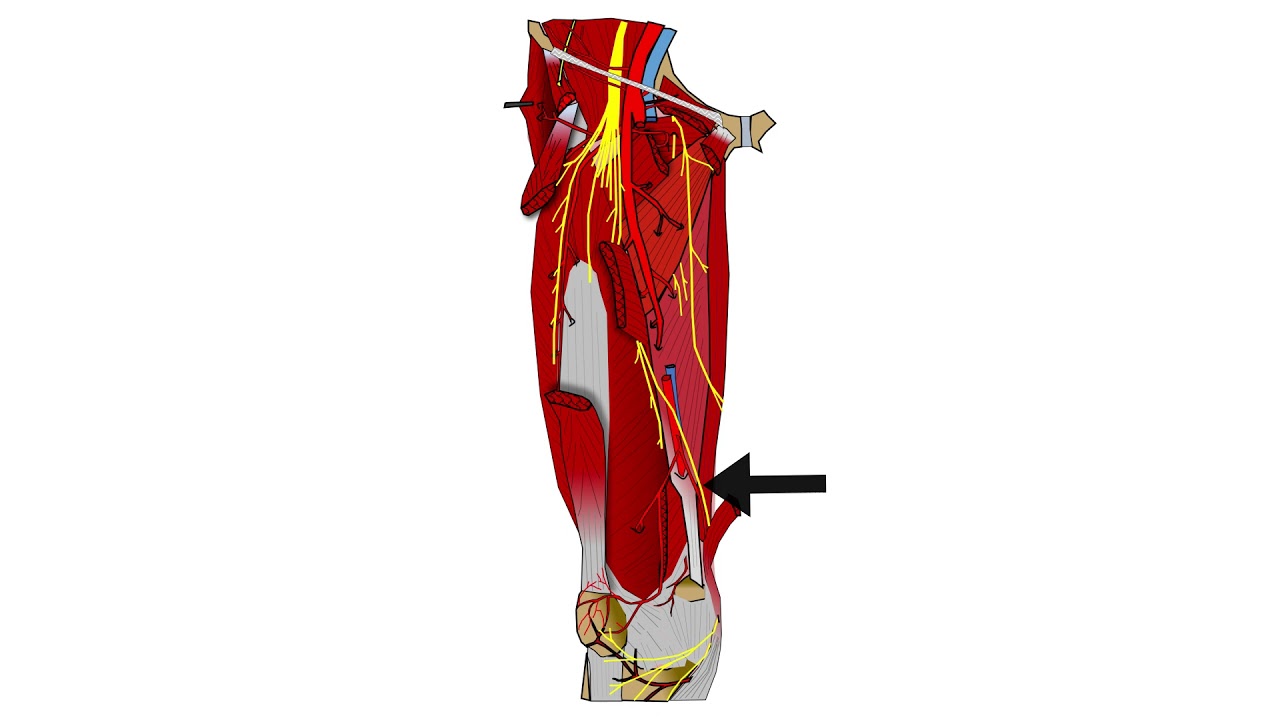 ECHOGRAPHIE DES NERFS DU MEMBRE INFÉRIEUR : C. BRUN NERF FÉMORAL