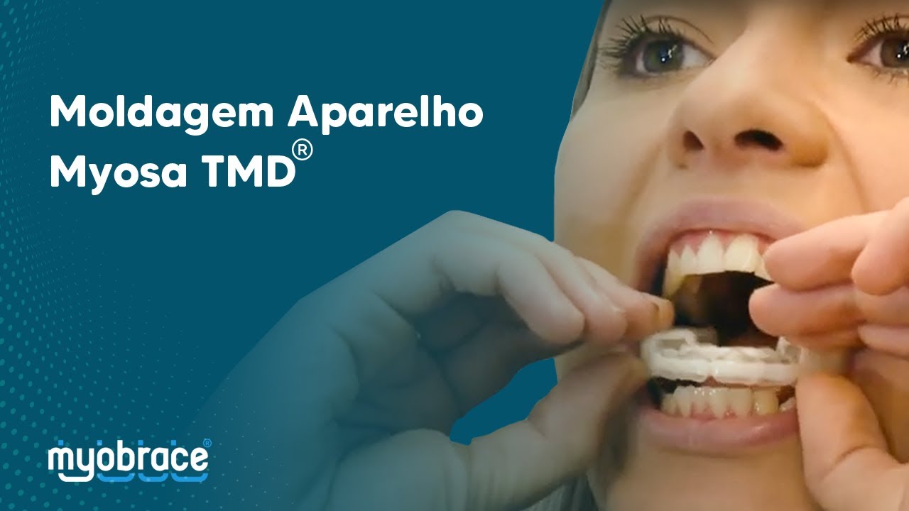 Moldagem Aparelho Myosa TMD