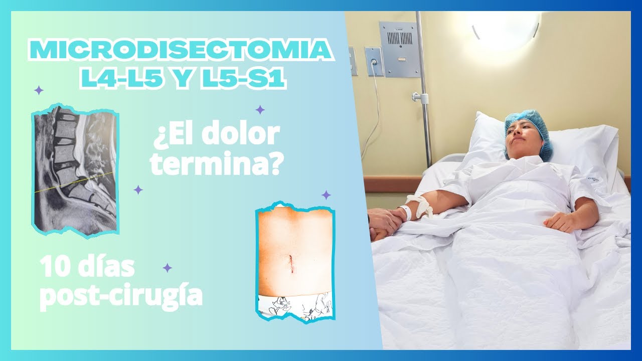 MICRODISECTOMIA DE HERNIA L4-L5 y L5-S1 | Operación de hernia lumbar | Cuento mi experiencia