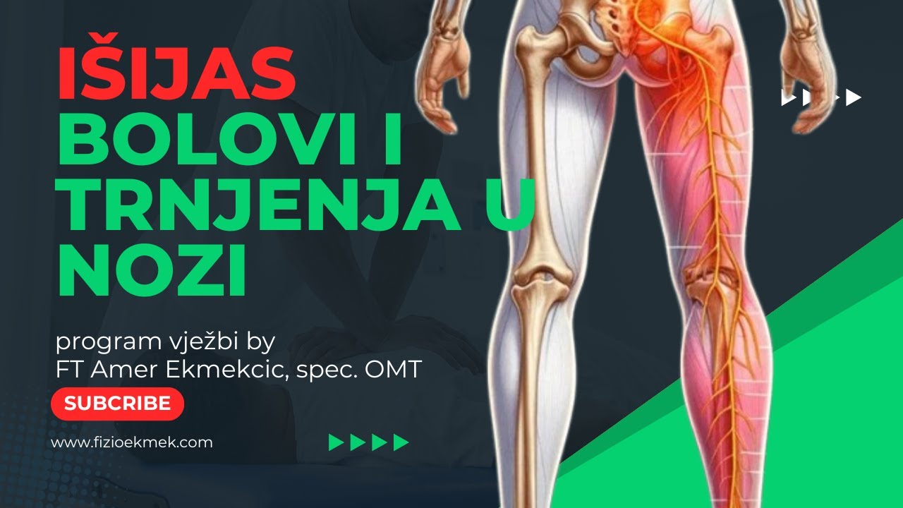 Bol u kuku i nozi zbog IŠIJASA? Radite ove vježbe!