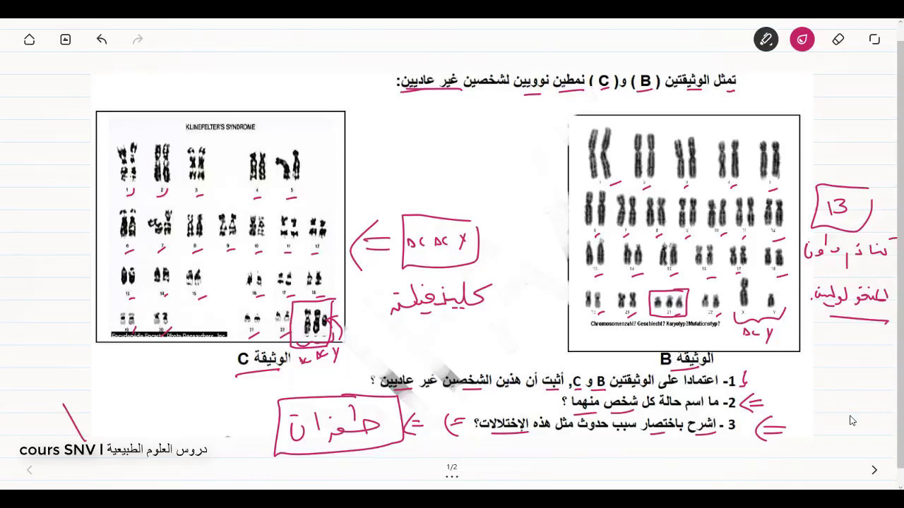 تمرين حول الامراض الوراثية و الطابع النووي