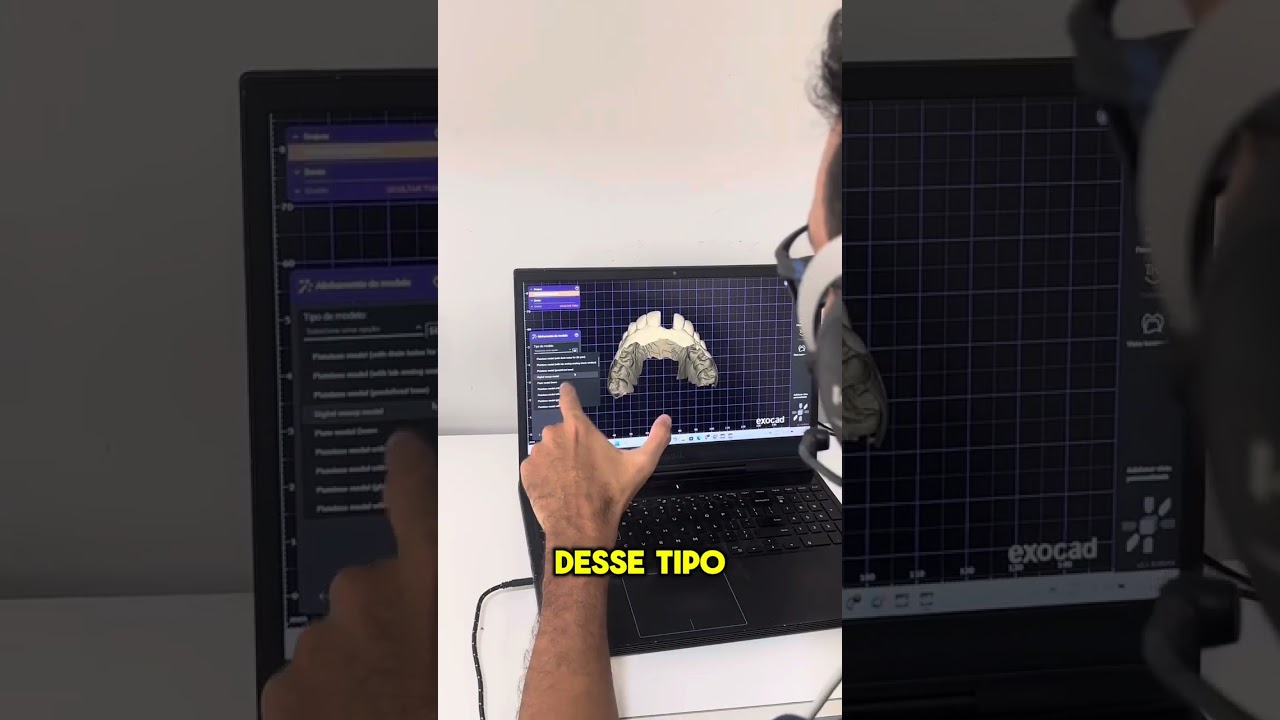 Como fazer modelo de Trabalho no Exocad.