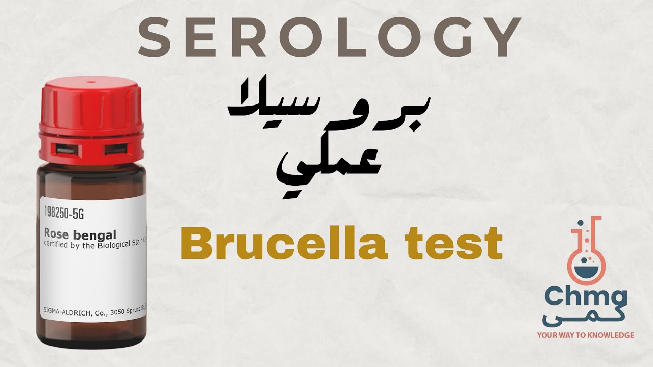 Rose bengal test عملي تحليل البروسيلا