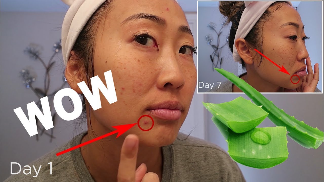I USED FRESH ALOE VERA FOR 7 DAYS AND LOOK WHAT HAPPENED!