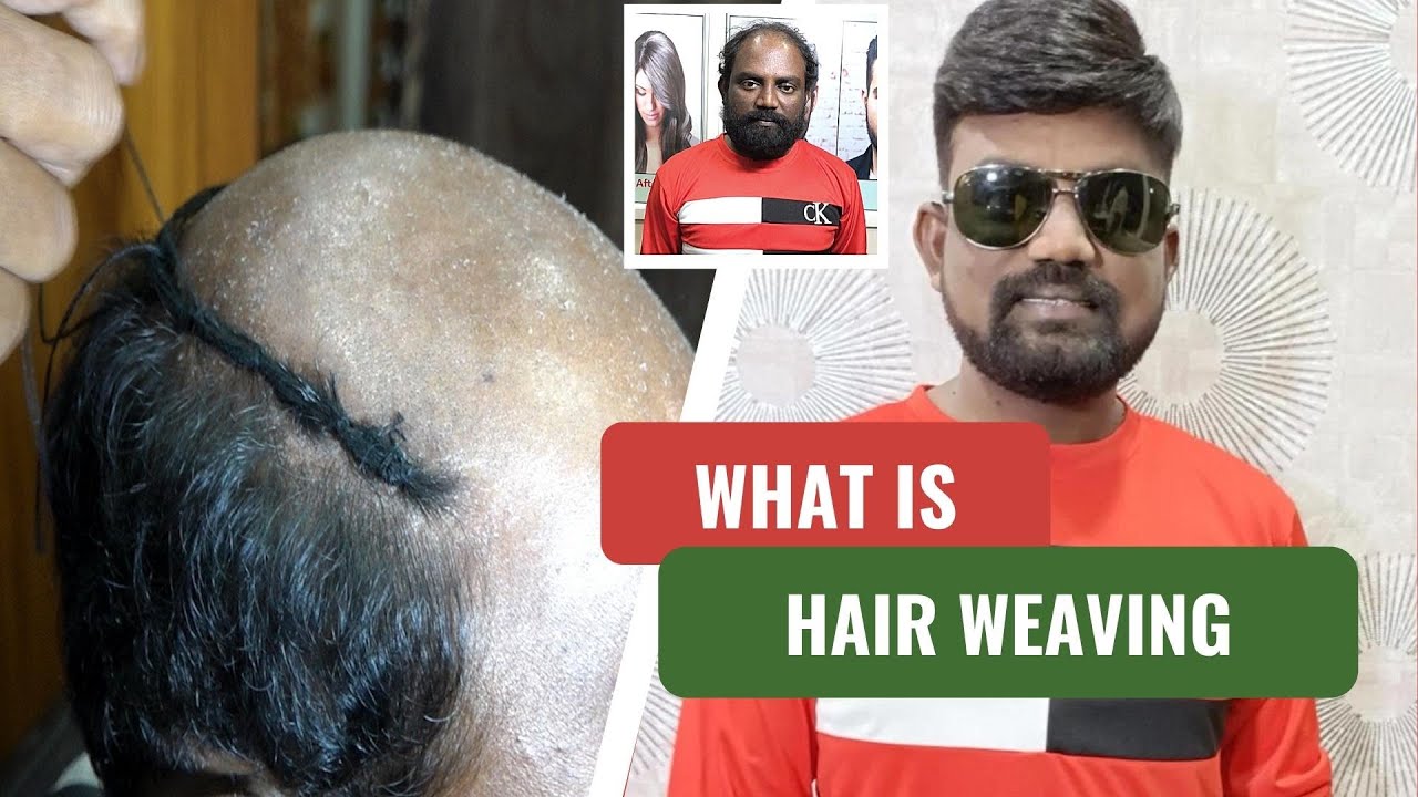 WHAT IS HAIR WEAVING PROCESS IN HAIR PATCHES FOR MEN | HAIR REPLACEMENT PROCESS