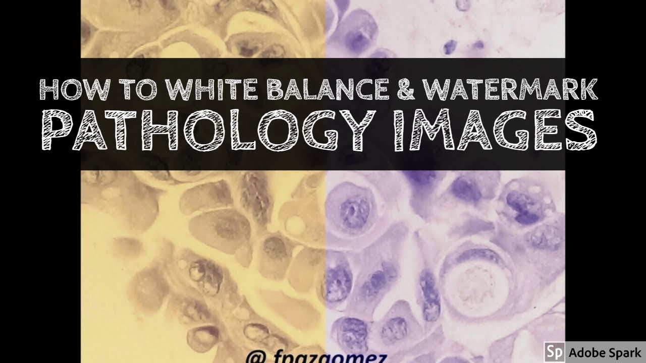 How to White Balance Pictures & Watermark Pathology Images for Social Media