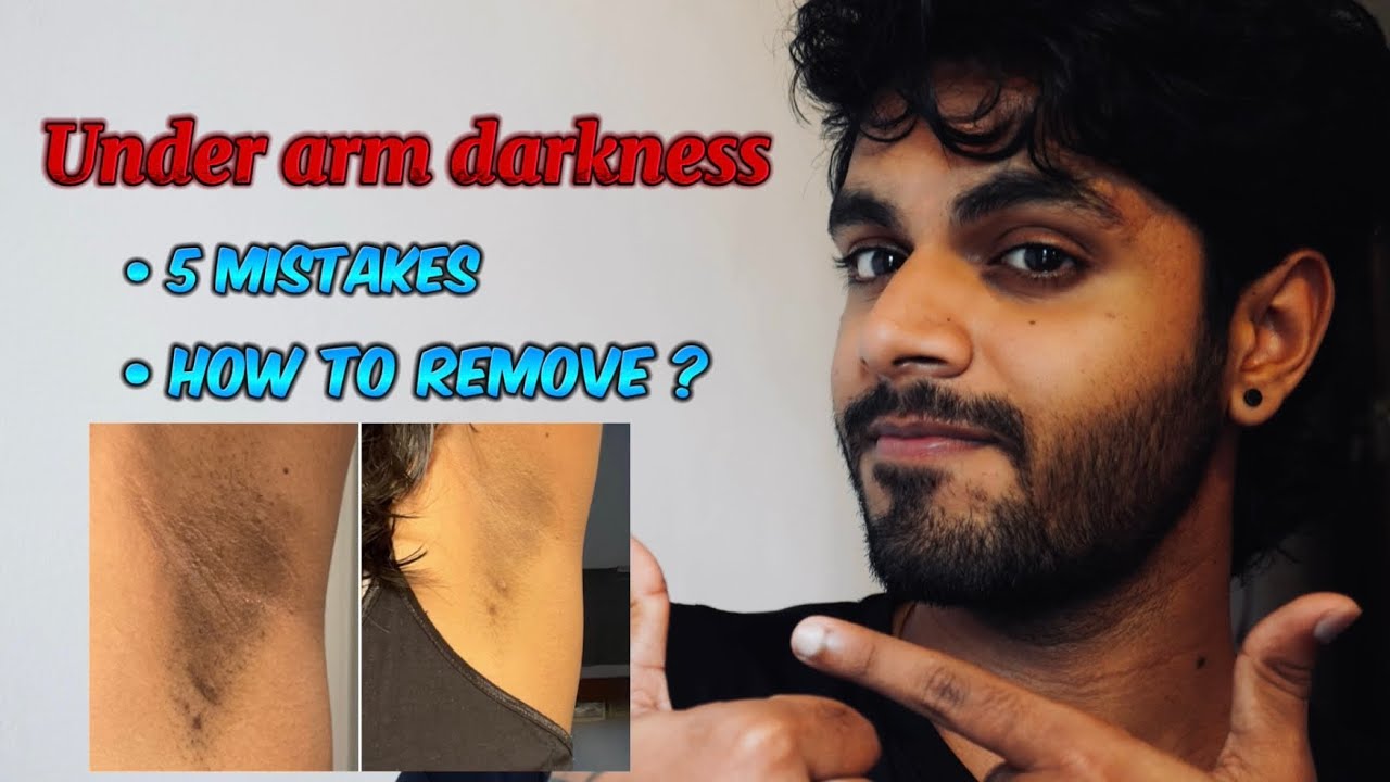 How to reduce underarm darkness & prevent pigmentation #itsmekuttuzz 