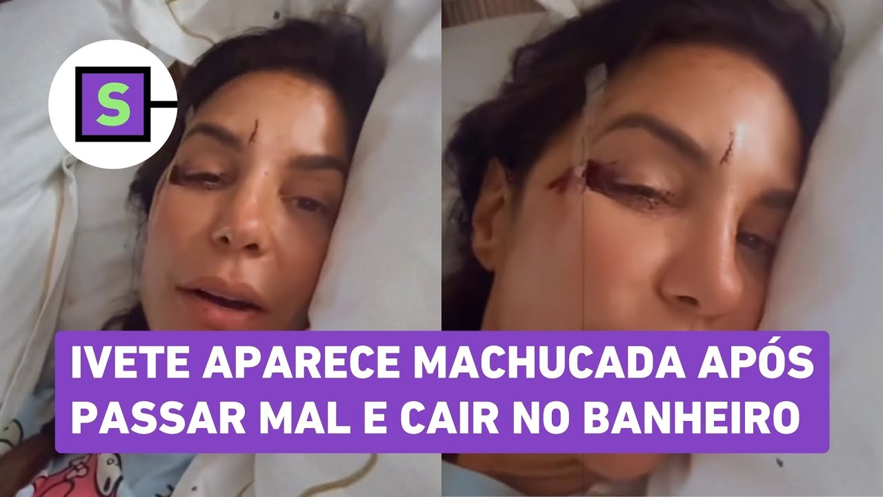 Ivete aparece machucada após passar mal e cair no banheiro