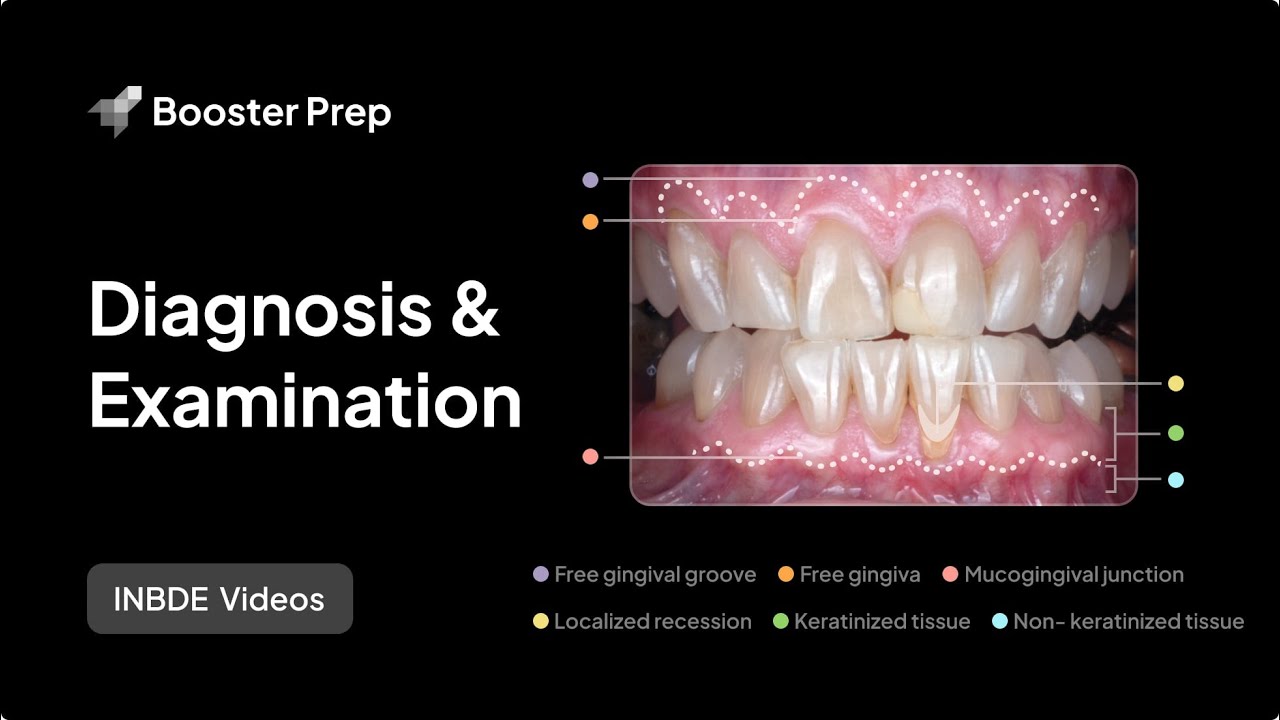 Periodontics | Diagnosis and Examination | INBDE, NDEB, ADAT