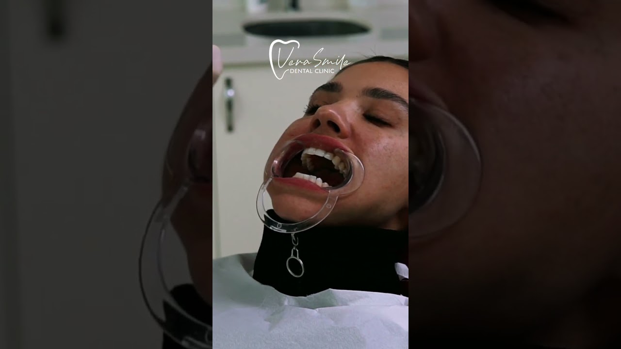 Best Options for Dental Cosmetics in Turkey: Vera Smile #shorts #dentalcosmetics #dentalclinicturkey