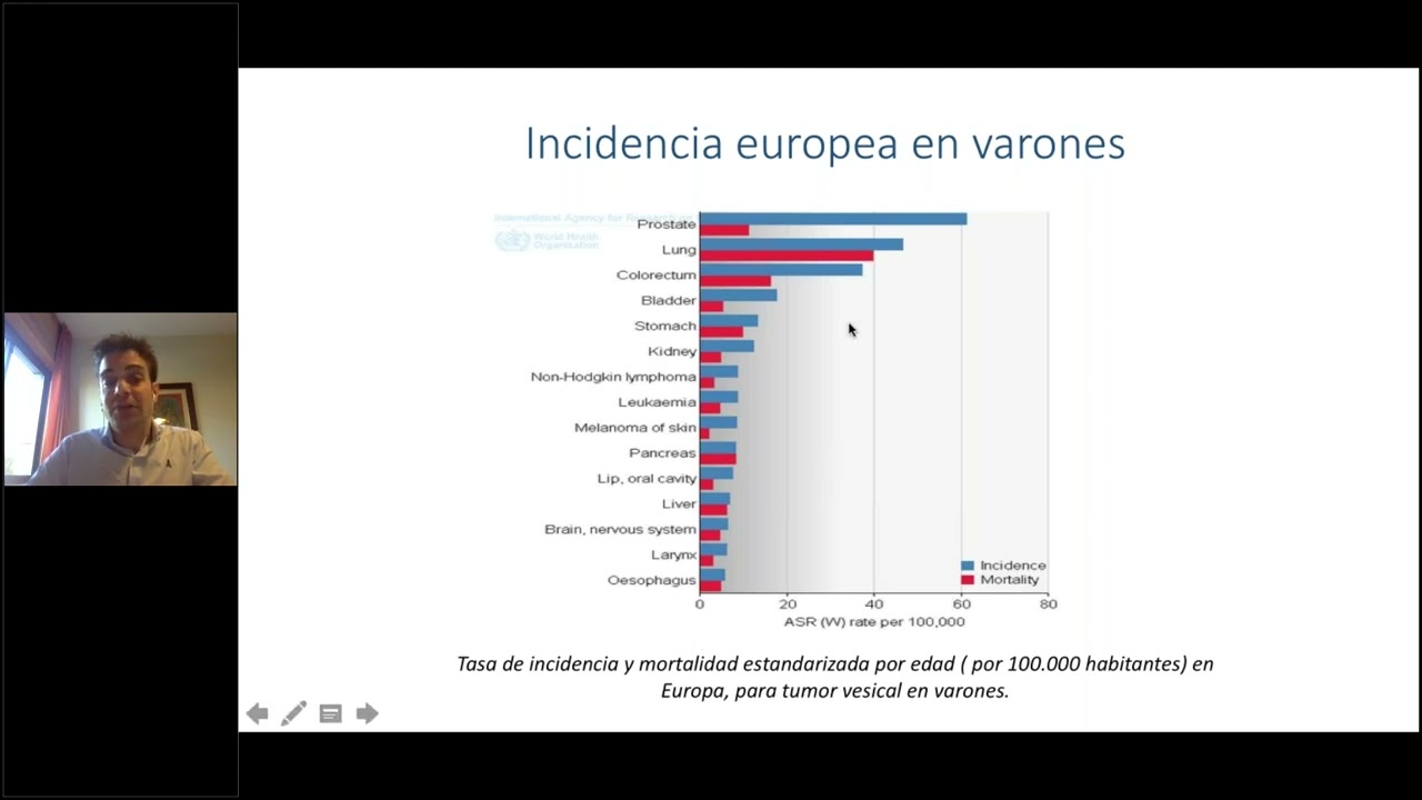 Cáncer de vejiga: diagnóstico y tratamiento
