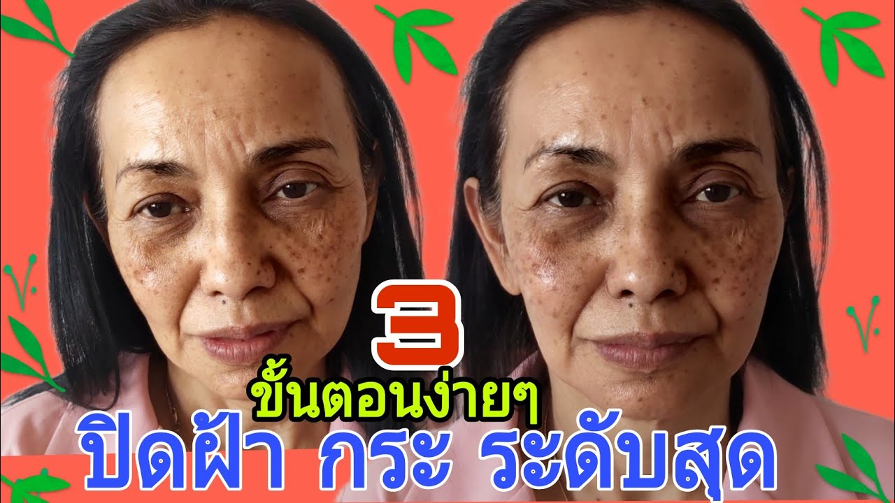 3 ขั้นตอน แต่งหน้า ปิดฝ้า กระ ระดับสุด  EP.26 3 STEPS TO COVER EXTREME PIGMENTATION #แต่งหน้าปิดฝ้า