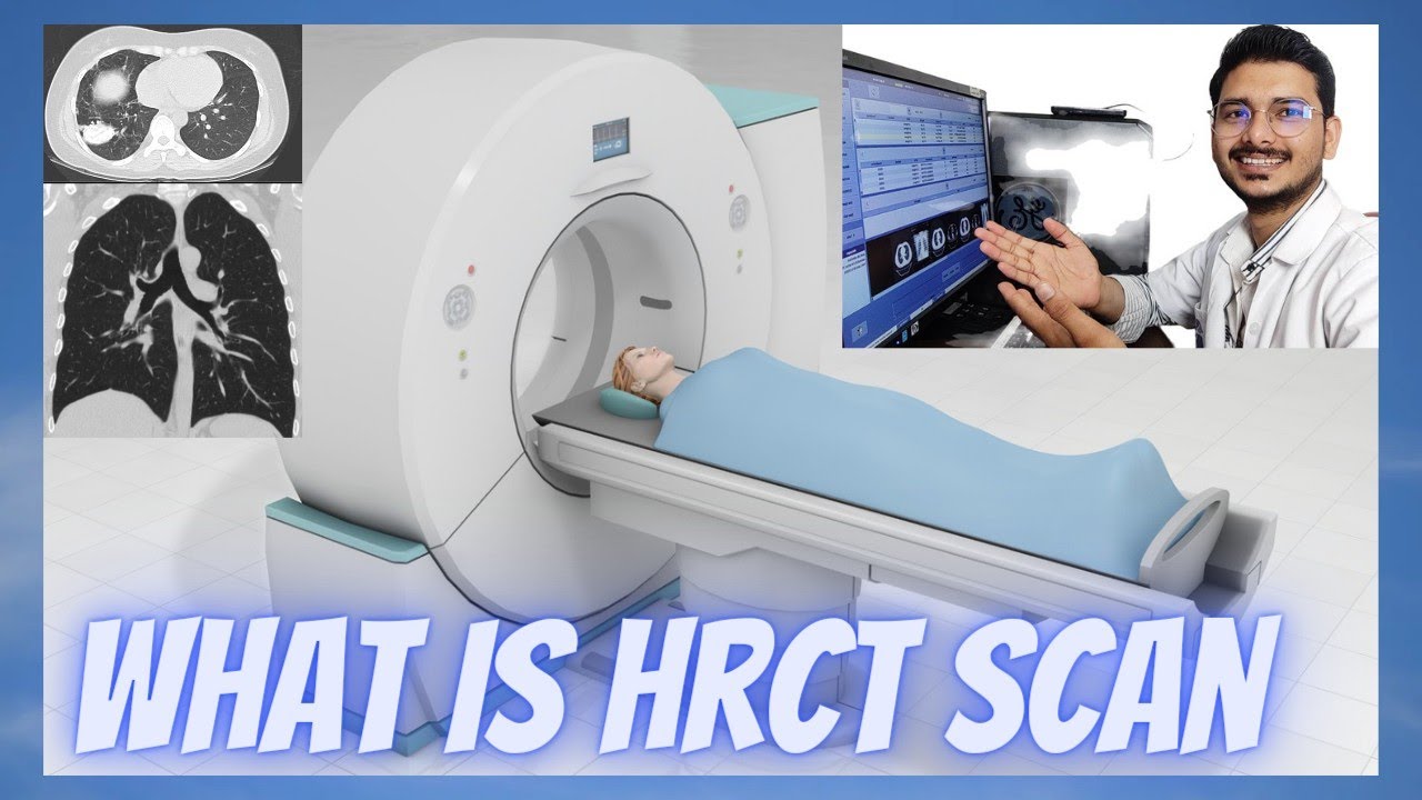 What is HRCT Scan | HRCT Chest scan explanation | एच आर सीटी स्कैन क्या होता है.