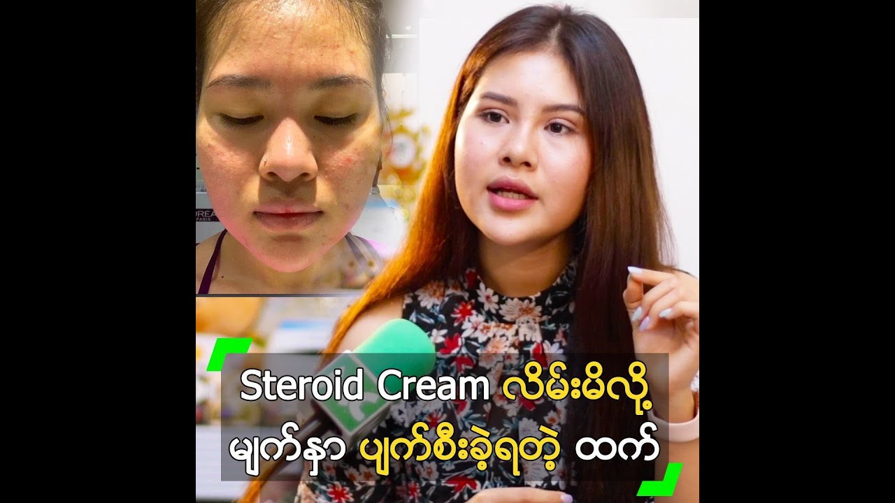 Steroid Cream လိမ်းမိလို့ မျက်နှာ ပျက်စီးခဲ့ရတဲ့ ထက်