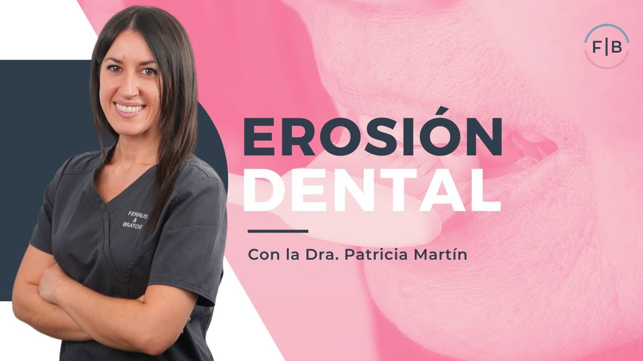 EROSI&Oacute;N DENTAL: &iquest;Por qu&eacute; se produce el DESGASTE de los DIENTES?✨