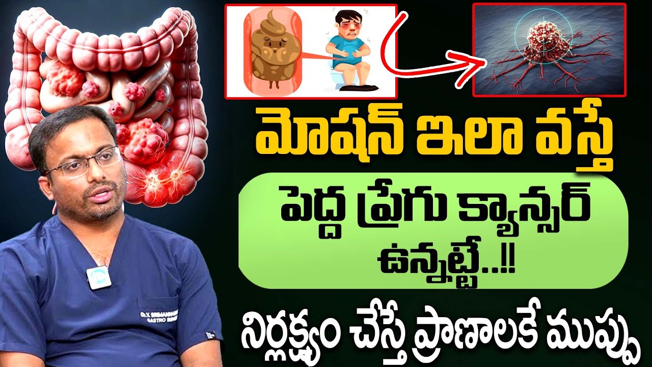 Ignore చేయకండి! 😲 పెద్ద ప్రేగు క్యాన్సర్ మొదటి సంకేతం ఇదే | Dr Srimannarayana | iDream Doctors