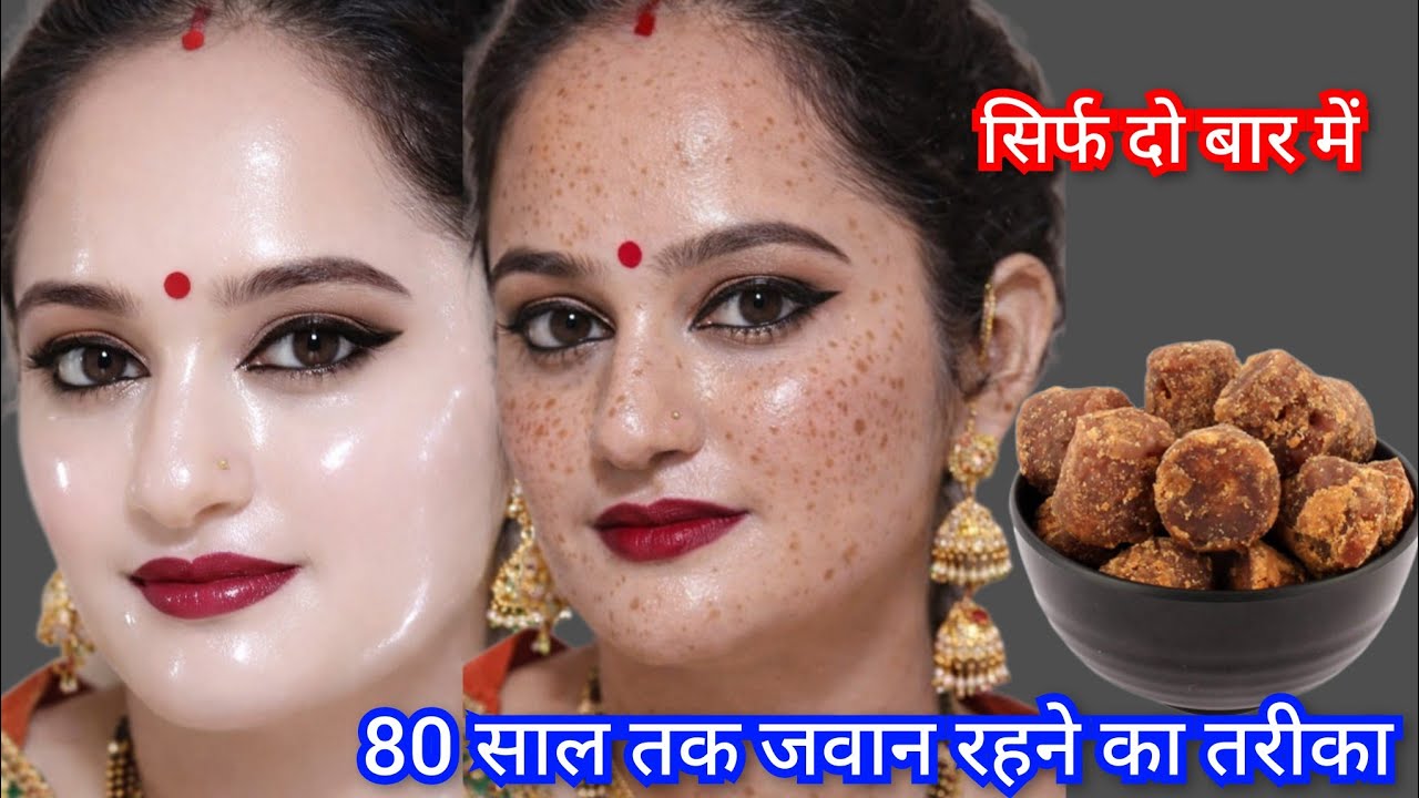 दो बूंद लगते ही मेरा चेहरा शीशे की तरह चमकने लगा👉10 साल पुरानी झाइयां काले दाग धब्बे सब साफ हो गए🙈