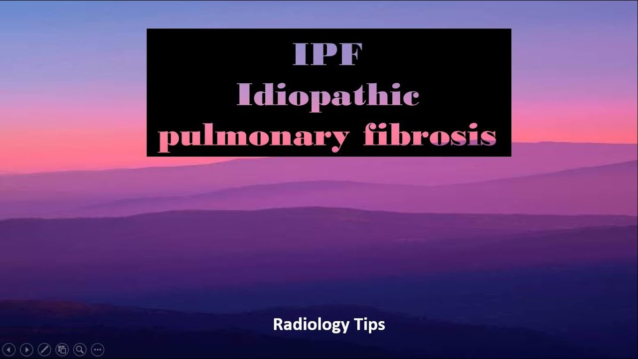 IPF( idiopathic pulmonary fibrosis/usual interstital pneumonia) Radiology