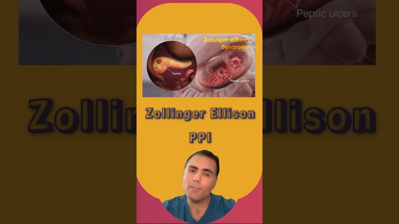 PPi for Zollinger-Ellison Syndrome