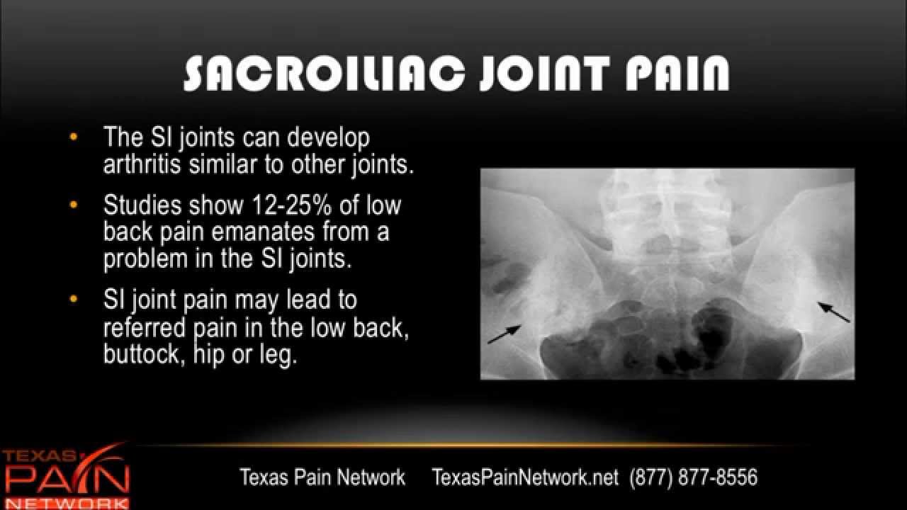SI Joint Pain Treatment info from a San Antonio Pain Clinic (210) 202-4030