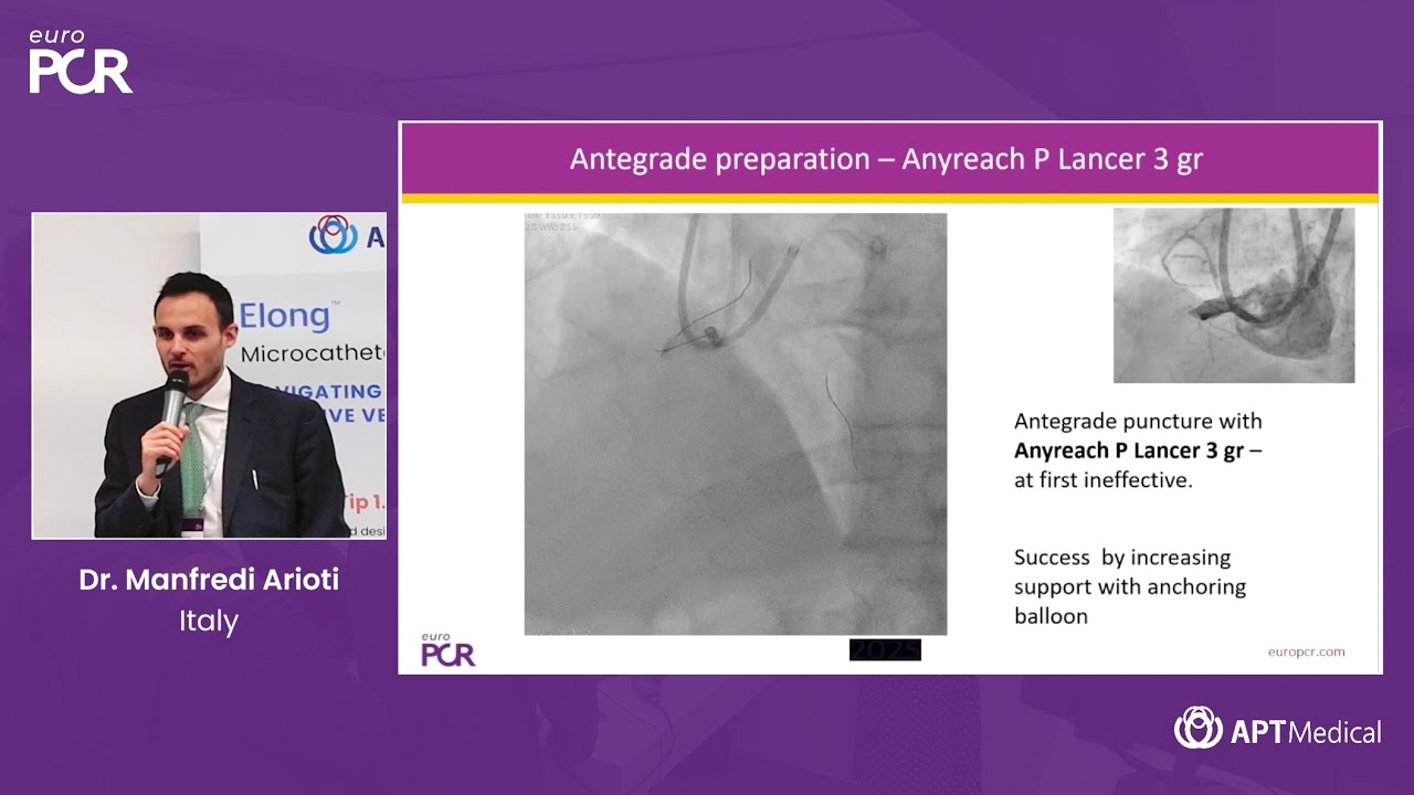 Strategies for Successful Revascularization with the Anyreach wires - Dr. Manfredi Arioti | EuroPCR