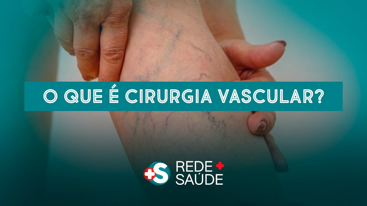 O QUE &Eacute; A ANGIOLOGIA (CIRURGIA VASCULA) ?