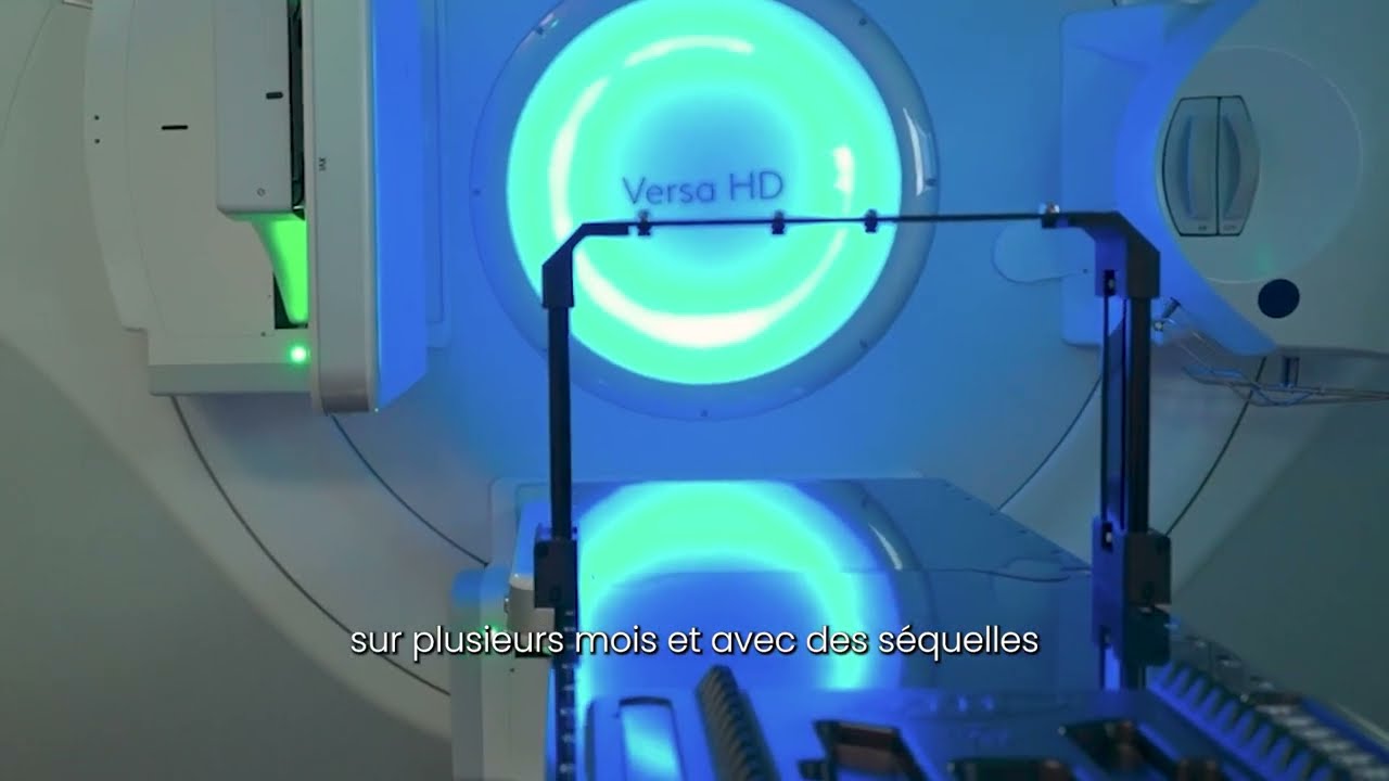 La  radiothérapie stéréotaxique