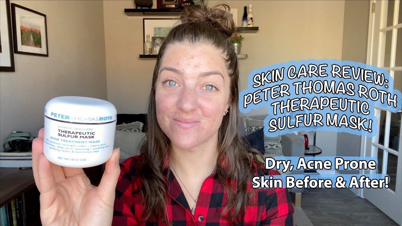 SKIN CARE REVIEW: PETER THOMAS ROTH THERAPEUTIC SULFUR MASK! Dry, Acne Prone Skin Before & After!