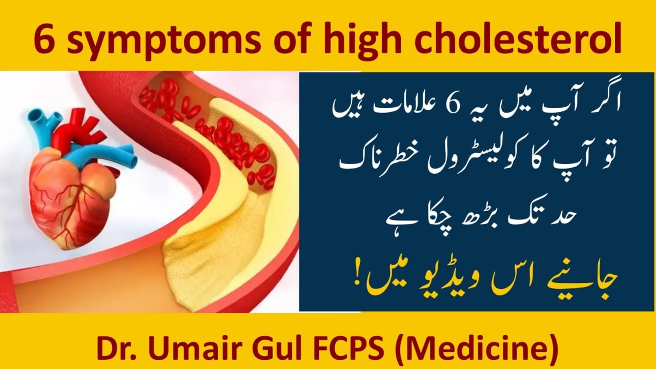 6 Symptoms of high cholesterol | high cholesterol ke alamat | by Dr Muhammad Umair Gul FCPS