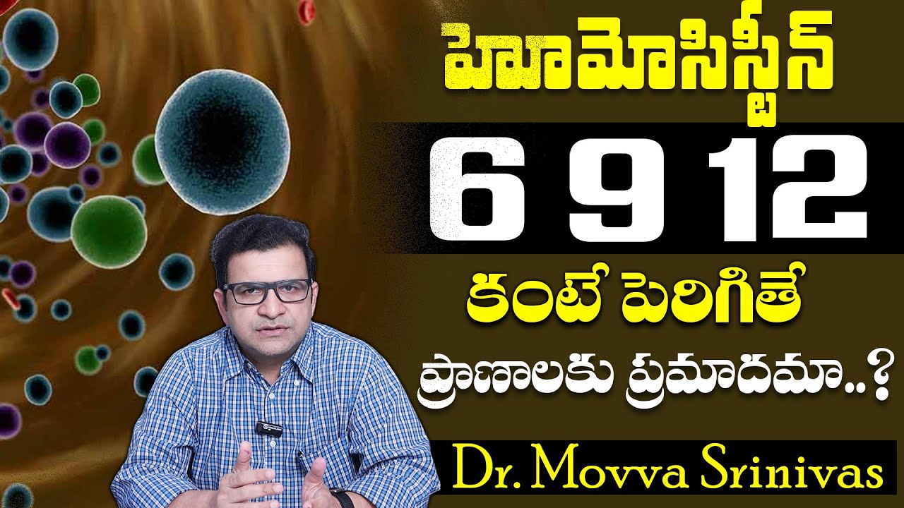 Dr. Movva Srinivas : What Causes of Chest Pain? | Heart Attack? | Checkup Homocysteine Test