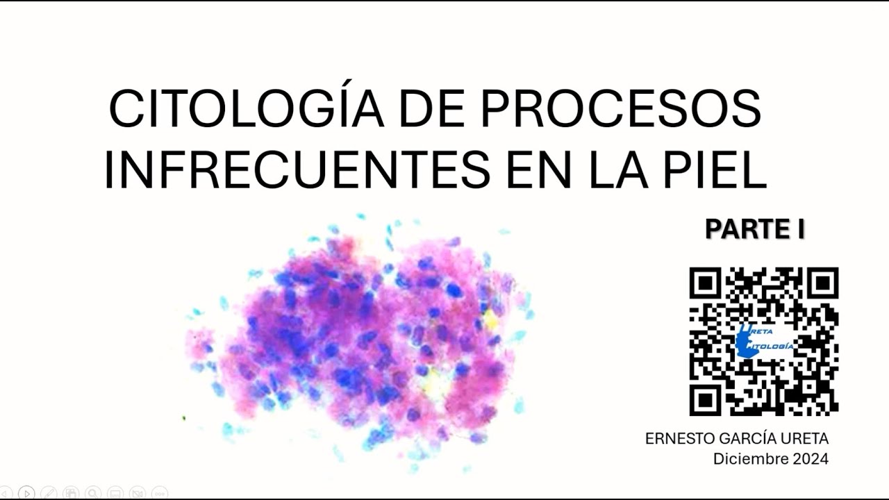 Citología de procesos infrecuentes de la piel. Parte I