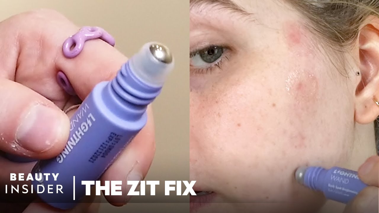 $10 Serum Wand Claims To Lighten Acne Scars | The Zit Fix | Beauty Insider